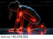 Joint inflammation, human skeleton, female body with pain spots, health problems concept. Стоковое AI-изображение, AI-художник Станислав Тарко / Фотобанк Лори