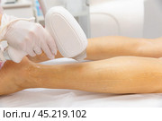 Elos epilation hair removal procedure on a woman body. Beautician doing laser rejuvenation in a beauty salon. Removing unwanted body hair. Hardware ipl cosmetology. Стоковое фото, фотограф Ирина Михайличенко / Фотобанк Лори