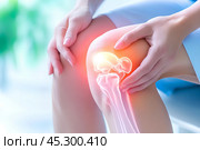 Больное колено у человека. Визуализация боли в коленном суставе. Стоковое AI-изображение, AI-художник Щеголева Ольга / Фотобанк Лори