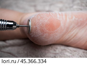 Hardware pedicure for yourself, chiropody and podology concept, foot care. Стоковое фото, фотограф Станислав Тарко / Фотобанк Лори