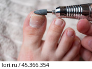 Hardware pedicure for yourself, ingrown toenail, chiropody and podology concept, foot care. Стоковое фото, фотограф Станислав Тарко / Фотобанк Лори