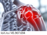 Close-up of the anatomy of the shoulder joint, focusing on the inflamed area. The red glow around the joint indicates possible inflammation, pain, or tissue damage, which may be due to conditions such as arthritis, trauma, sprain, or cartilage damage. The background of the image is neutral to emphasize the medical nature of the scene. This illustration is often used in a medical context to demonstrate joint pathology and explain the causes of pain. Стоковое AI-изображение, AI-художник Анна Кривицкая / Фотобанк Лори