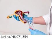 Doctor or nurse holding pathology Uterus and Ovaries model. Ovarian and Cervical cancer, Cervix disorder, Endometriosis, Hysterectomy, Uterine fibroids, Reproductive system and Pregnancy concept. Стоковое фото, фотограф Ирина Михайличенко / Фотобанк Лори