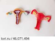 Top view healthy and pathology anatomical models of the uterus and Ovaries. Reproductive system concept. Ovarian and Cervical cancer, Cervix disorder, Endometriosis, Hysterectomy, Uterine fibroids. Стоковое фото, фотограф Ирина Михайличенко / Фотобанк Лори