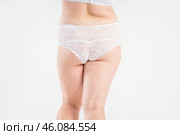 Overweight thigh, woman with fat hips, buttocks and varicose veins, obesity female body with cellulite on gray background. Стоковое фото, фотограф Станислав Тарко / Фотобанк Лори