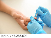 Doctor using lancet to get blood sample for test, closeup. Стоковое фото, фотограф Pixel_shot / Фотобанк Лори