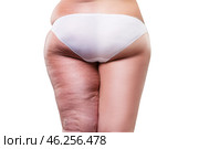 Overweight woman with fat cellulite legs and buttocks, before after concept, obesity female body, rear view. Стоковое фото, фотограф Станислав Тарко / Фотобанк Лори