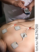 A practitioner adjusts a device used for therapeutic muscle stimulation on a client's back, which has electrodes placed for treatment. Стоковое фото, фотограф Aleksandr Golubev / Фотобанк Лори
