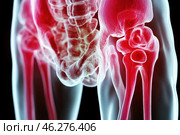 A medical illustration of the hip joint and upper thigh bones as seen on an X-ray or MRI scan. The joint area is colored red, indicating inflammation, degenerative changes, or pathology associated with pain and dysfunction. The background is darkened and the bones are translucent, creating the effect of a medical scan. The image may be related to themes of arthritis, osteoarthritis, trauma, or surgery. Стоковое AI-изображение, AI-художник Анна Кривицкая / Фотобанк Лори