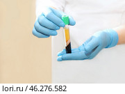 Medical test tube with blood Plasma in his hands for PRP therapy. Стоковое фото, фотограф Ольга Зиновская / Фотобанк Лори