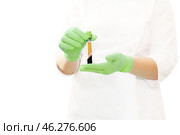 Medical test tube with blood plasma in hand for PRP therapy, after centrifuge. Стоковое фото, фотограф Ольга Зиновская / Фотобанк Лори