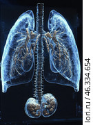X-ray image of human lungs. Medical imagery, lung health, radiology and anatomy, showcasing the human chest, healthcare practices. Black background. Стоковое AI-изображение, AI-художник Ирина Михайличенко / Фотобанк Лори