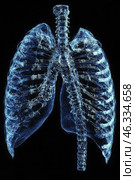 X-ray image of human lungs. Medical imagery, lung health, radiology and anatomy, showcasing the human chest, healthcare practices. Black background. Стоковое AI-изображение, AI-художник Ирина Михайличенко / Фотобанк Лори