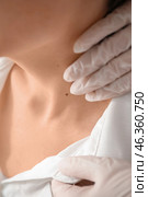 Dermatologist examining mole on young woman's neck in clinic, closeup. Стоковое фото, фотограф Pixel_shot / Фотобанк Лори