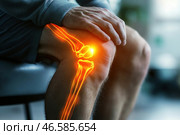 A person holding their knee, indicating possible pain or injury. A digital graphic is superimposed, showing the bones of the knee joint, with the painful area highlighted in bright orange. This creates the effect of an x-ray or medical imaging, focusing attention on the problem area. The background is slightly blurred, and the overall tone of the image conveys a sense of medical themes related to orthopedics, traumatology or sports medicine. Стоковое AI-изображение, AI-художник Анна Кривицкая / Фотобанк Лори