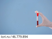 Лаборант держит пробирку с образцом крови на цветном фоне. Стоковое фото, фотограф Pixel_shot / Фотобанк Лори