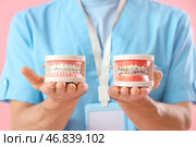 Мужской стоматолог, держащий модели челюсти с брекетами на розовом фоне, крупным планом. Стоковое фото, фотограф Pixel_shot / Фотобанк Лори