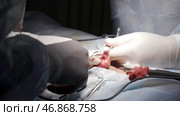 Close up of surgeon hands stitches a wound after the surgery of the male genital system. Стоковое фото, фотограф David Kashakhi / Фотобанк Лори