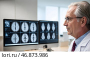 A neurosurgeon discusses brain surgery. Стоковое AI-изображение, AI-художник Александр Поташев / Фотобанк Лори