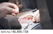 Close up of surgeon hands stitches a wound after the surgery of the male genital system. Стоковое фото, фотограф David Kashakhi / Фотобанк Лори
