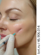 Beautician injecting filler into woman's cheek for facial rejuvenation. Стоковое AI-изображение, AI-художник Юрий Поздников / Фотобанк Лори