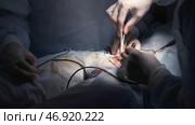 Close-up of professional surgeons completing complex operation under anesthesia. Стоковое фото, фотограф David Kashakhi / Фотобанк Лори