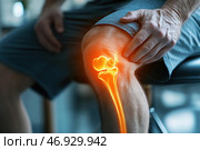 Illustrates the problem of knee pain related to joints or bones. The focus is on the leg of a man who is holding his knee, expressing discomfort. Overlaid on top of the photo is a digital rendering of the bone and joint, highlighted in bright orange, symbolizing inflammation, injury or degenerative disease.The background is blurred, creating an emphasis on the problem area. This image is often used in medical materials to illustrate arthritis, knee injuries, osteoporosis or age-related changes in bone tissue. Стоковое AI-изображение, AI-художник Анна Кривицкая / Фотобанк Лори