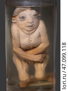 April 1, 2023. Belarus, Minsk. Exhibition of anatomical exhibits. Human infant with pathological development of microcephaly. Human dwarf. Achondroplasia. Редакционное фото, фотограф Лазаренко Светлана / Фотобанк Лори