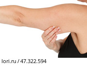 Close-up of woman pinching the fat on her arm. Стоковое фото, фотограф Nobilior / Фотобанк Лори