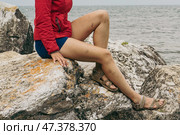 Many bruises on women's legs. Стоковое фото, фотограф Екатерина Якименко / Фотобанк Лори