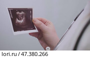 Obstetrician explains ultrasound results to patient, offering optimal methods for conception and vitamin therapy. Стоковое видео, видеограф Svetlana Golovco / Фотобанк Лори
