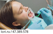Dentist applying adhesive to patients teeth before aligner placement during orthodontic procedure. Стоковое видео, видеограф Дмитрий Наумов / Фотобанк Лори