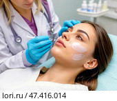 A cosmetologist injects fillers into the lips of a beautiful girl. Using hyaluronic acid based fillers. Injection cosmetology. Стоковое AI-изображение, AI-художник Сергей Елизарьев / Фотобанк Лори