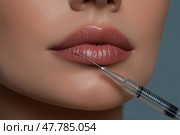 Close-Up of Lip Filler Injection – Needle and Syringe Procedure on Woman's Lips. Филлер для губ - один из самых популярных видов дермальных наполнителей, которые вводятся в губы женщины иглой и шприцем крупным планом. Стоковое AI-изображение, AI-художник Katsiaryna Repich / Фотобанк Лори