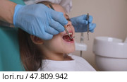 Close up dentist, doctor examines the oral cavity of a little girl, uses a mouth mirror, baby teeth close-up. Concept of pediatric dentistry, dental treatment. Slow motion footage. Стоковое видео, видеограф Ирина Михайличенко / Фотобанк Лори
