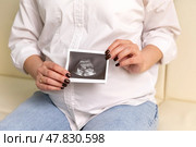 Prenatal ultrasound screening. Cropped close up shot of young pregnant female holding sonogram picture of unborn baby inside her big belly. Happy expectant mom showing fetus scan image to camera. Стоковое фото, фотограф Ирина Михайличенко / Фотобанк Лори