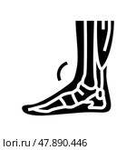 tendonitis problem glyph icon vector illustration. Стоковая иллюстрация, иллюстратор Vectorwin / Фотобанк Лори