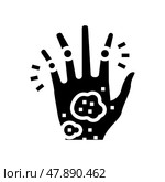 psoriatic arthritis skin health problem glyph icon vector illustration. Стоковая иллюстрация, иллюстратор Vectorwin / Фотобанк Лори