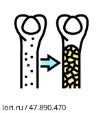 osteoporosis bone disease color icon vector illustration. Стоковая иллюстрация, иллюстратор Vectorwin / Фотобанк Лори