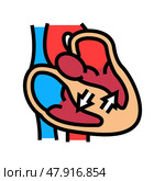 hypertrophic cardiomyopathy cardiology color icon vector illustration. Стоковая иллюстрация, иллюстратор Vectorwin / Фотобанк Лори