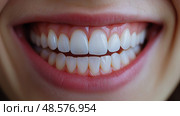 Close up of a smiling young woman's teeth. Dentistry concept.. Крупный план зубов улыбающейся молодой женщины. Концепция стоматологии. Стоковое AI-изображение, AI-художник Katsiaryna Repich / Фотобанк Лори