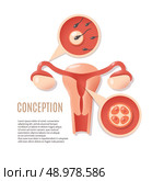 Medical genecology educational early pregnancy visualization schema fertilization and embryo implantation poster icon print abstract vector illustration. Стоковая иллюстрация, агентство Ingram Publishing / Фотобанк Лори