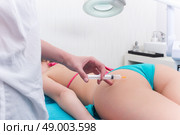 Woman getting anticellulite and anti fat therapy in beauty salon. Стоковое фото, агентство Ingram Publishing / Фотобанк Лори