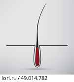 hair follicle treatment design. Стоковая иллюстрация, агентство Ingram Publishing / Фотобанк Лори