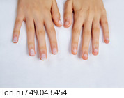 woman hands with nails before treatment on white towel in salon. Стоковое фото, агентство Ingram Publishing / Фотобанк Лори