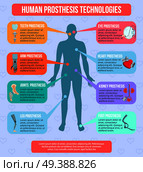 Human medical prothesis modern technologies flat infographic poster with integrated implants robotic arms artificial joints vector illustration . Human Prothesis Technologies Infographics. Стоковая иллюстрация, агентство Ingram Publishing / Фотобанк Лори