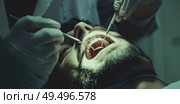 A professional dentist is carefully brushing the teeth of a man in a dental office setting. Стоковое AI-изображение, AI-художник Данила Большаков / Фотобанк Лори