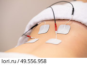 Electro stimulation in the lumbar zone in physical therapy to a young woman in a physiotherapy center.. Electro stimulation in physical therapy to a young woman. Стоковое фото, агентство Ingram Publishing / Фотобанк Лори