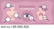 Worms in human body flat poster with intestinal parasites helminths larvae in eyes brain tissues vector illustration. Стоковая иллюстрация, агентство Ingram Publishing / Фотобанк Лори