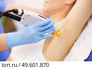 Woman receiving underarm laser hair removal at a beauty center. Laser depilation treatment in an aesthetic clinic.. Woman receiving underarm laser hair removal at a beauty center. Стоковое фото, агентство Ingram Publishing / Фотобанк Лори